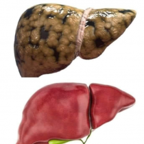 Taxanaha xikmadda Q:4aad