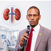 Wasiirka Caafimaadka Somaliland oo Shaaciyey Qorshe Lagu Hirgelinayo Beddelka Kelyaha