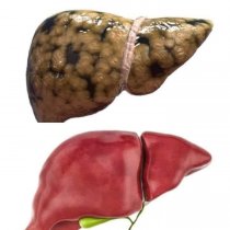 Taxanaha xikmadda Q:4aad